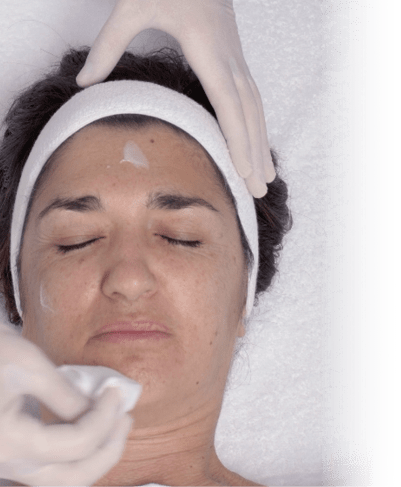 Peeling Eneomey Application Prepeel